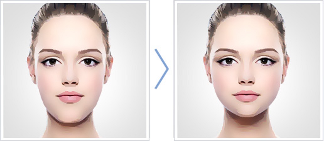 آنچه که در مورد جراحی فک باید بدانیم