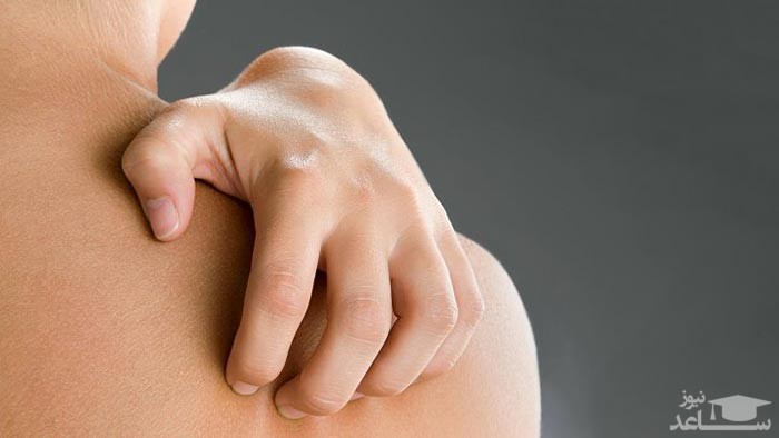 میزان و نحوه مصرف داروی کورتیران یا تریامسینولون (Triamcinolone)