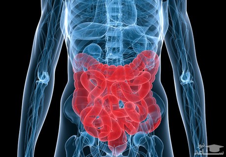 بیماری سلیاک و راههای درمان آن