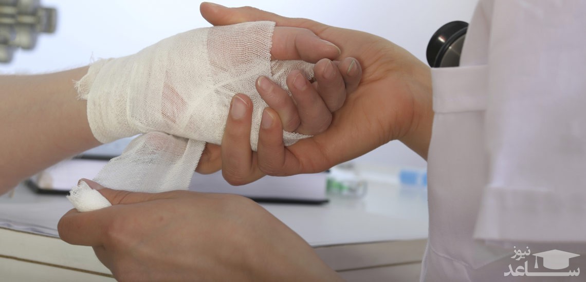 درمان خانگی برای سوختگی