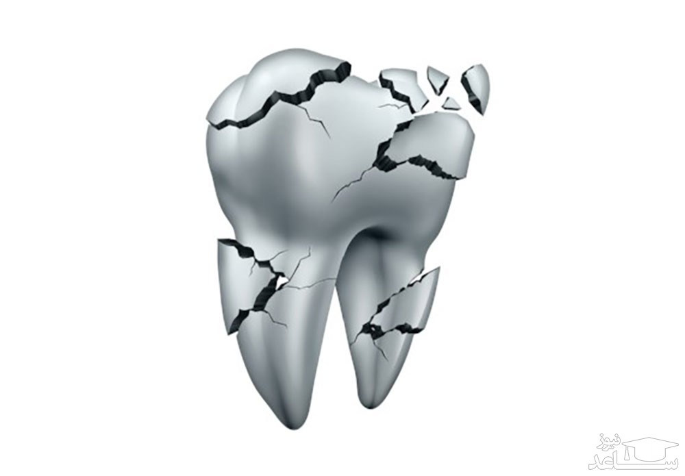 انواع دندان و عملکرد آنها چیست؟