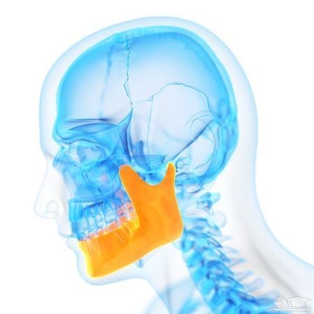 استئونکروز استخوان فک چیست؟