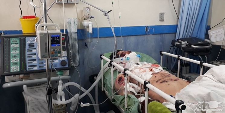 نخستین قربانی چهارشنبه سوری در اصفهان/قطع دست پسر 18 ساله