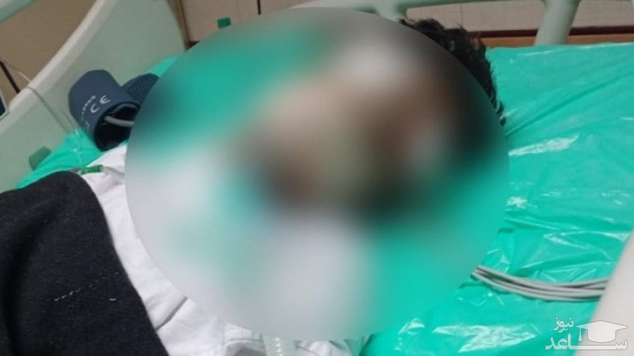 حمله موش ها به بیمار در بخش مراقبت های ویژه بیمارستان!