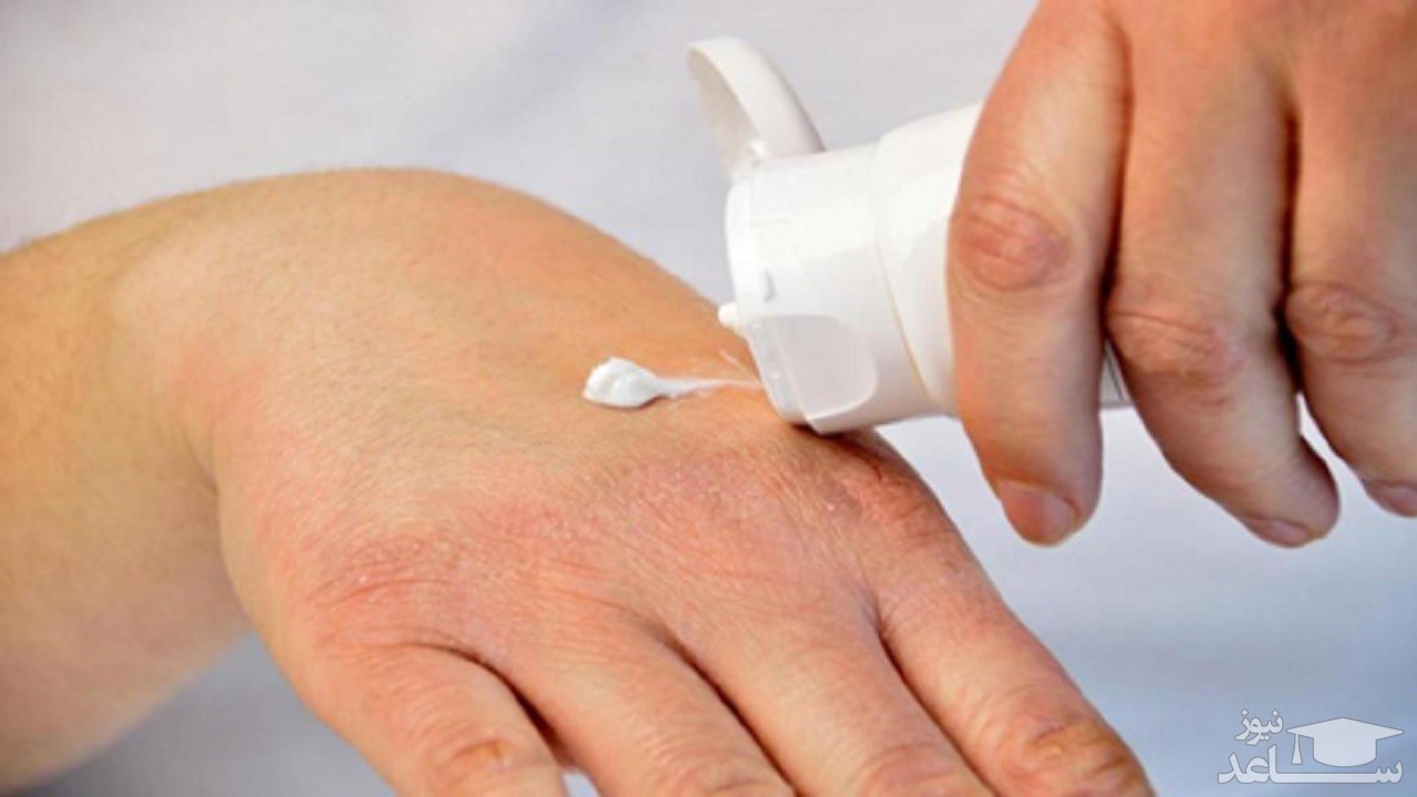 جلوگیری از خشکی پوست دست در موقع خانه تکانی