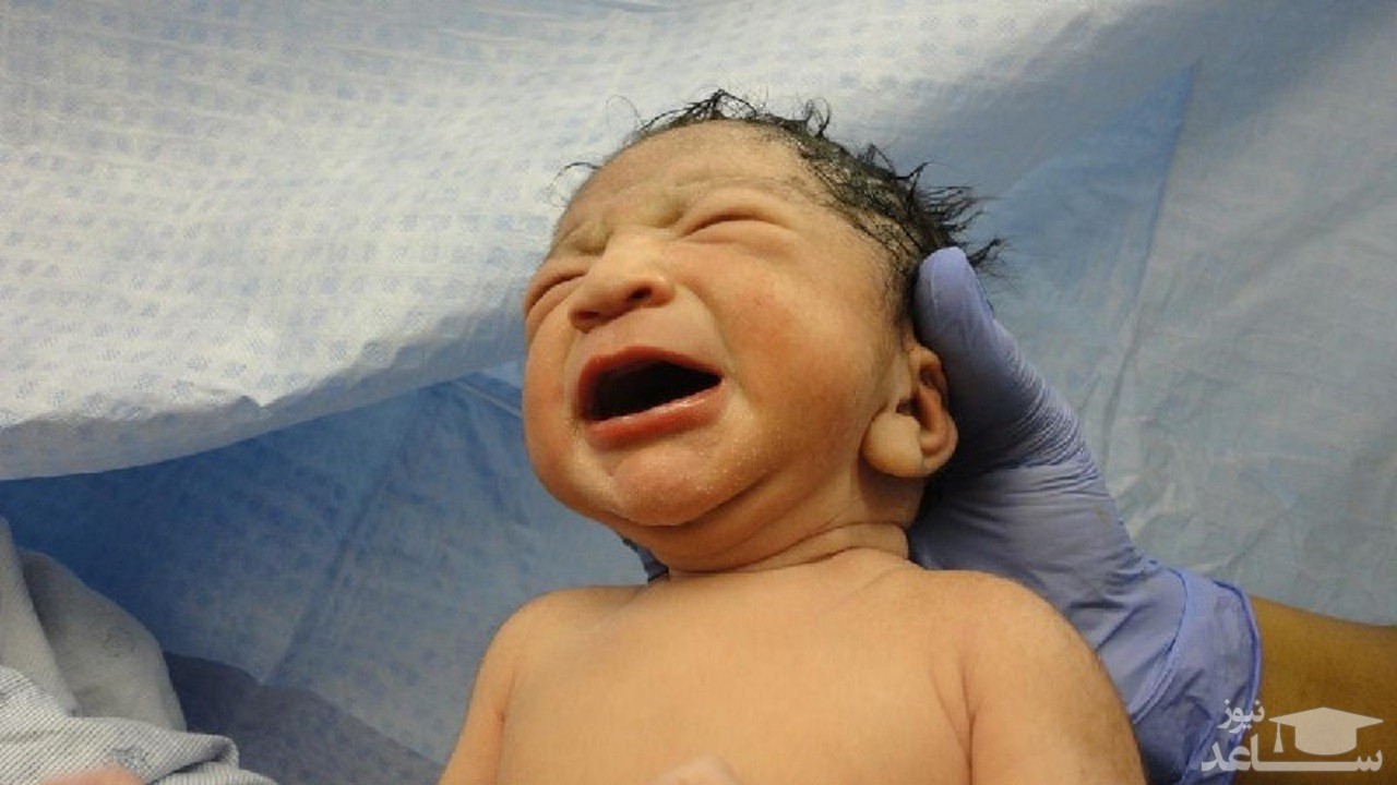 تولد نوزاد عجیب الخلقه در برزیل! + عکس