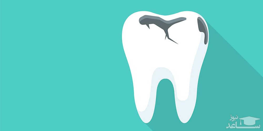 فرق جرمگیری معمولی دندان با جرمگیری عمیق چیست؟