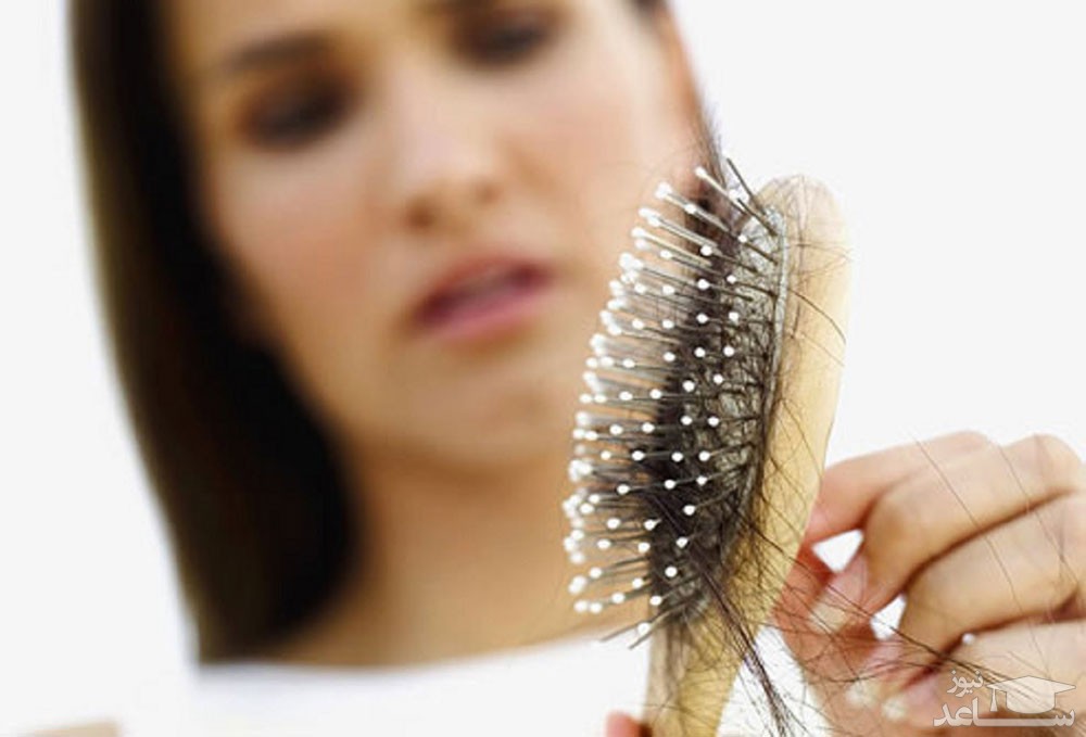 ۲۴ روش جالب برای تقویت و رشد موهای سر