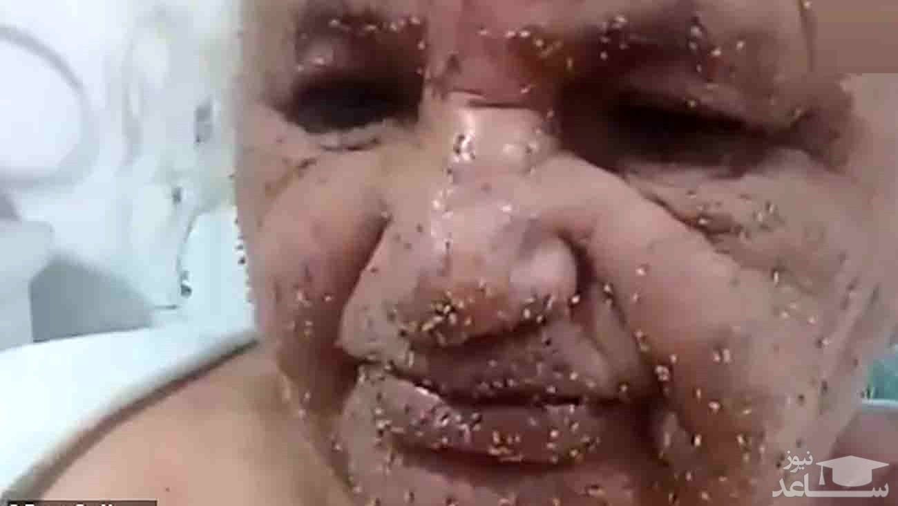 حمله وحشتناک زنبورها به 2 زن