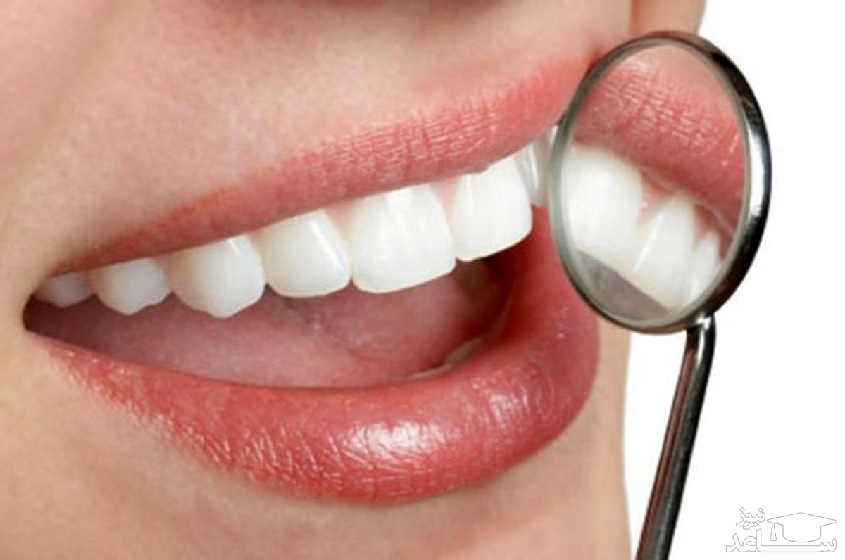 جرم گیری دندان ها با سرکه سیب چگونه میباشد؟
