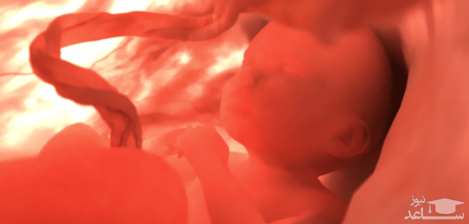 خطرات حامله شدن با وجود سندروم پلی کیستیک