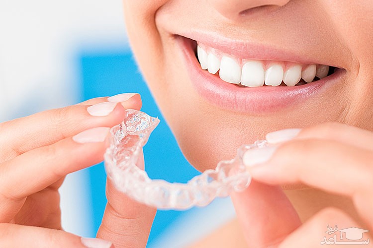 تاثیر ارتودنسی اینویزیلاین در اصلاح دندان‌ها