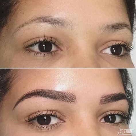 میکروبلیدینگ ابرو