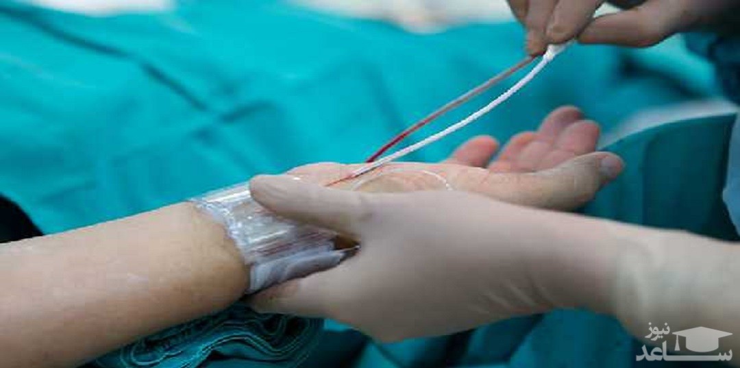 آنژیوگرافی