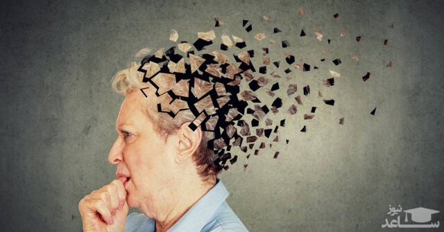 درمان آلزایمر در سطح آزمایشگاهی