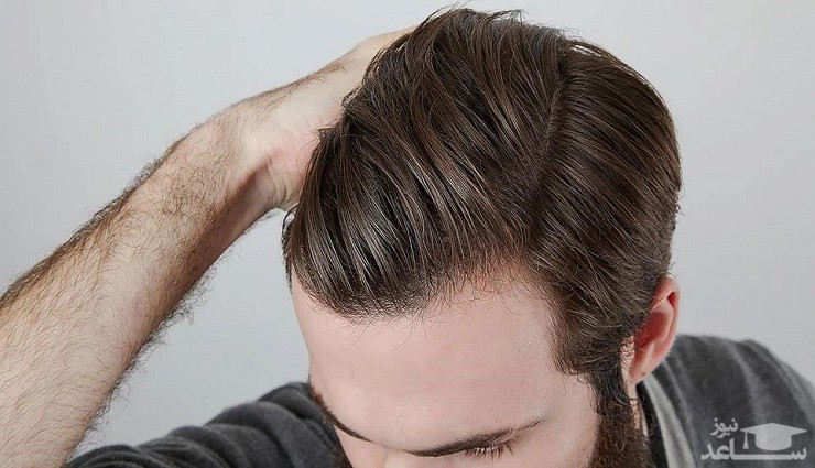 نکات مهم برای مراقبت از موی آقایان
