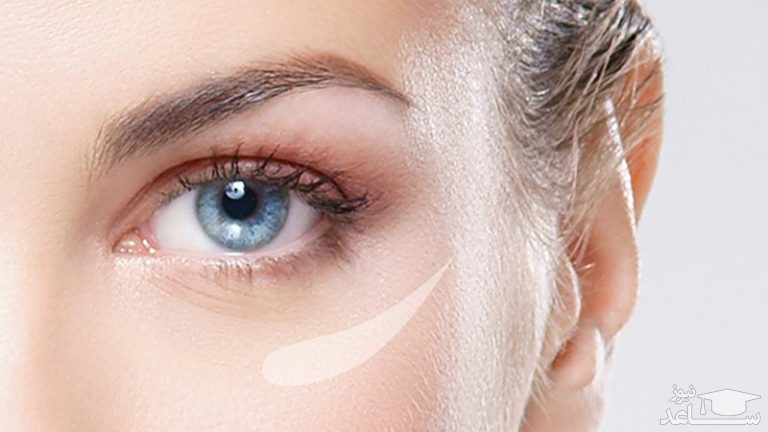نکاتی برای مراقبت از پوست زیر چشم