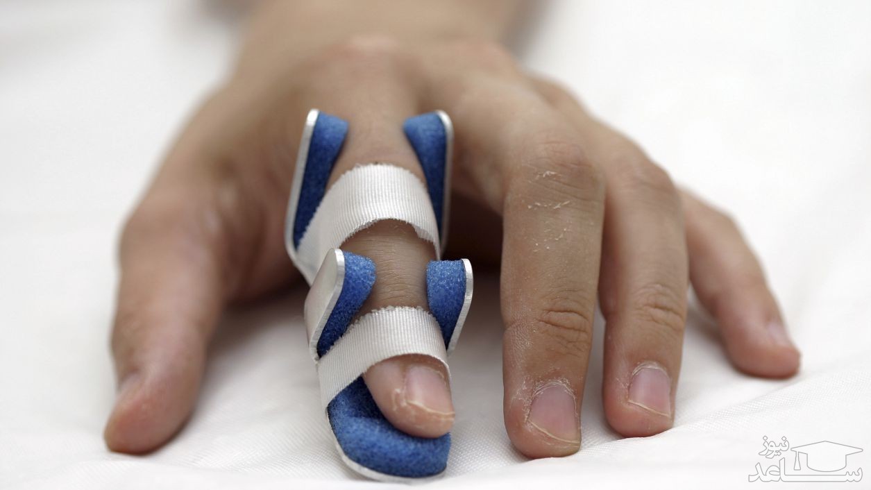 حرکات ورزشی و اقدامات لازم بعد از درمان شکستگی انگشتان دست