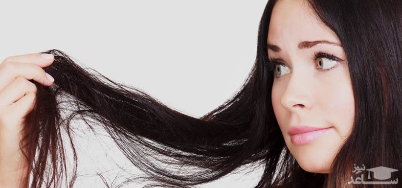 ریزش موی هورمونی چه ربطی به بیماری تیروئید دارد؟