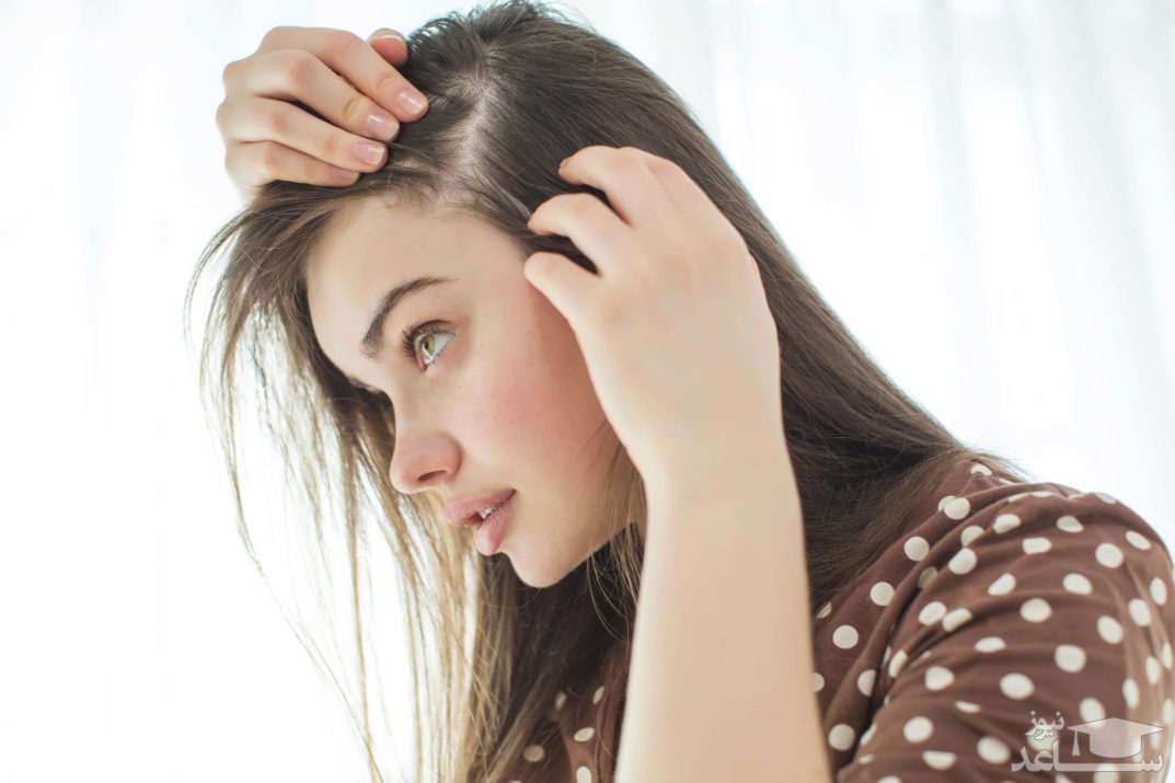 تاثیر کمبود فریتین بر ریزش مو