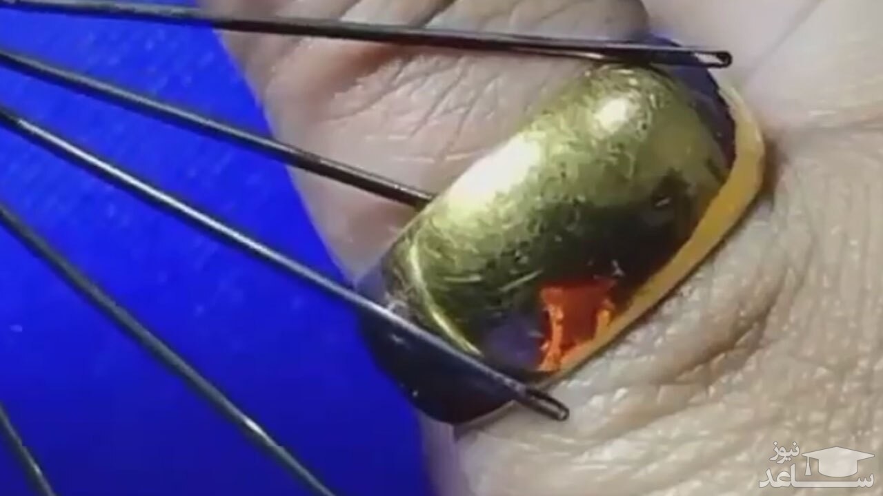 (فیلم) یک راه حل جالب برای در آوردن انگشتر تنگ از دست