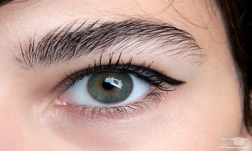 بلفاروپلاستی با دستگاه پلاسما جت برای رفع افتادگی پلک