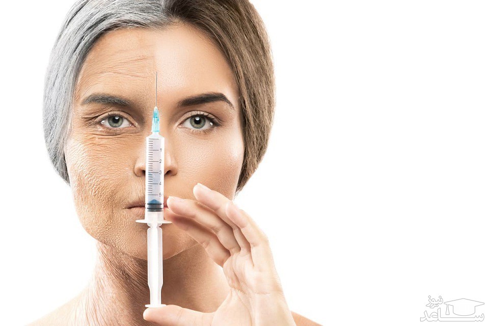 چگونه باید بین بوتاکس و ژل‌ های تزریقی، یکی را انتخاب کرد؟