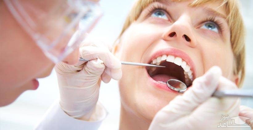 لکه های قهوه ای روی دندان و درمان آن