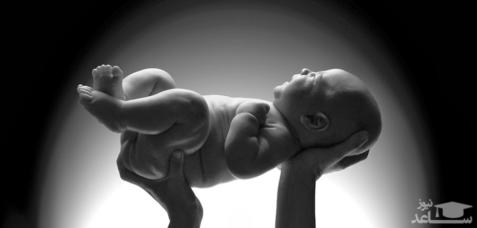 آیا میتوان بعد از عمل سزارین، زایمان طبیعی انجام داد؟