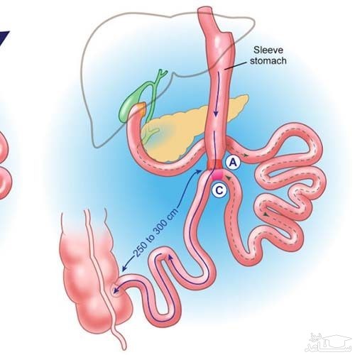 جلوگیری از بروز بیماری های قلبی و عروقی و سکته های مغزی