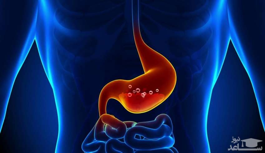 آنفولانزای معده و راههای درمان آن