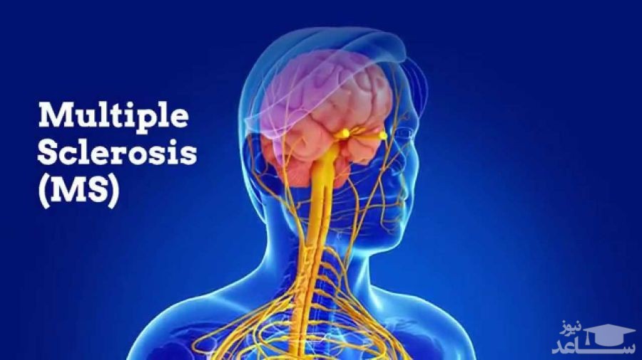 موارد منع مصرف و تداخل دارویی قرص پروجیو