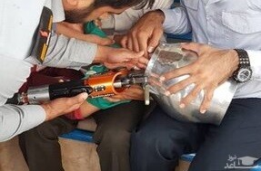 (عکس) گیر کردن سر کودک یاسوجی در زودپز!