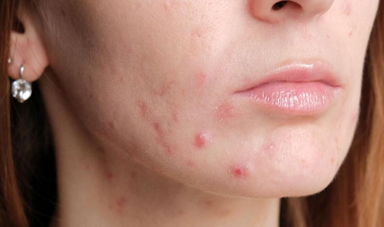 تغییرات صورت و قیافه در دوران بارداری