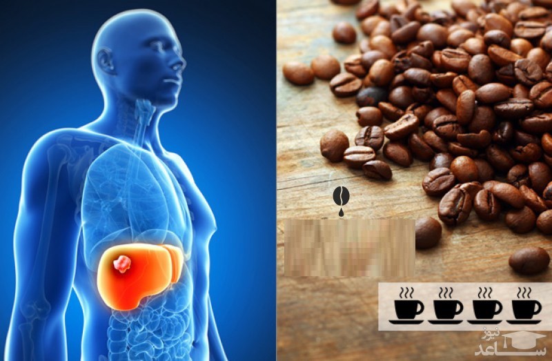 نحوه درمان کبد چرب با قهوه