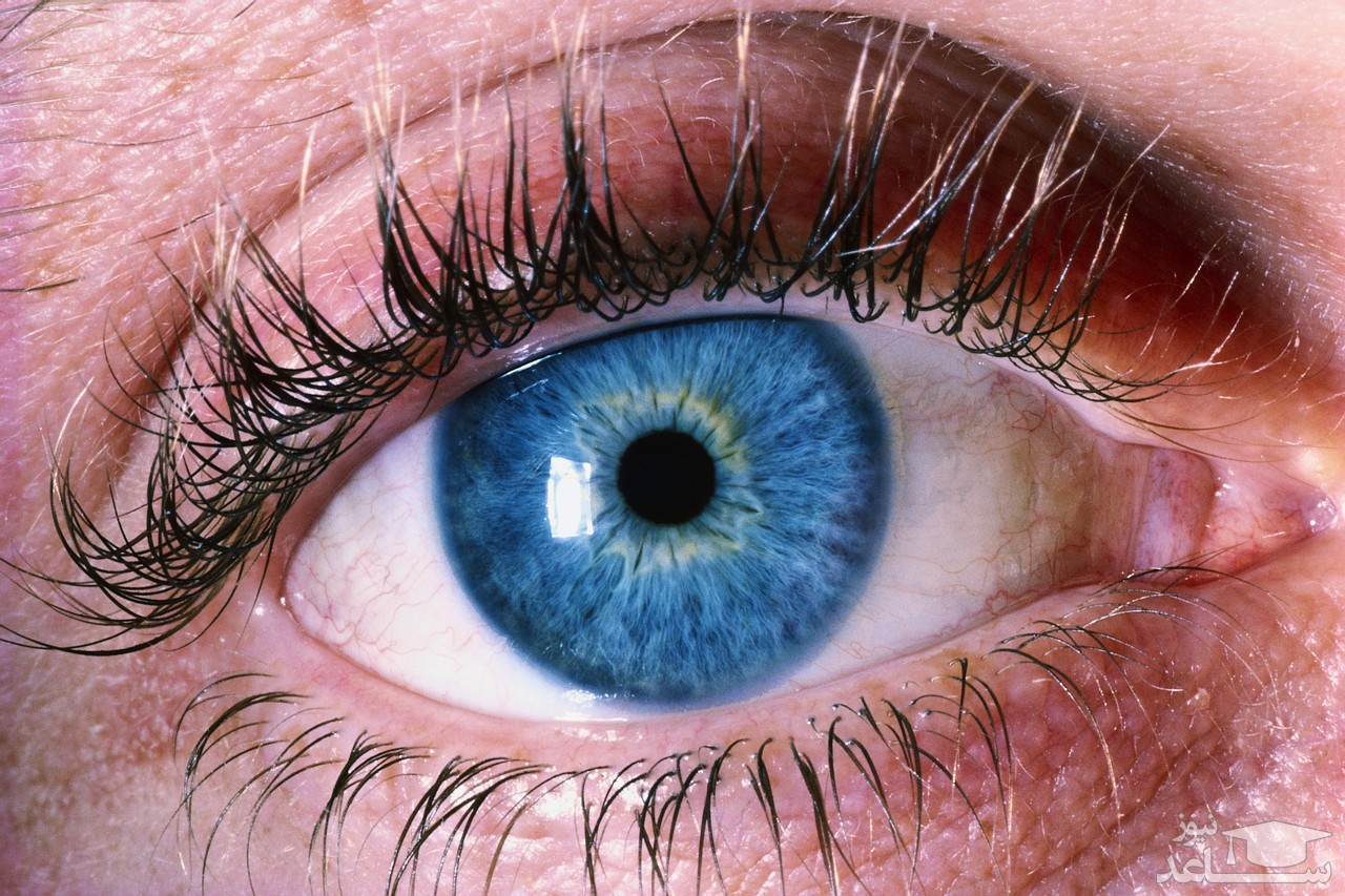 موارد منع مصرف و تداخل دارویی پنی سیلامین