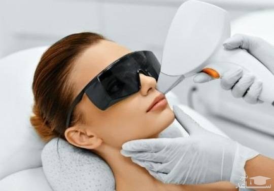 نکات مهم در خصوص لیزر موهای زائد