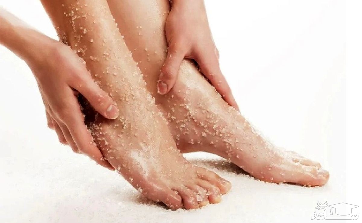 لایه برداری پوست