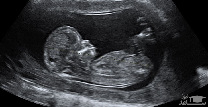 آزمایش و تست های غربالگری در دوران بارداری
