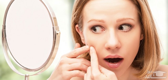 چرا جوش می زنیم؟