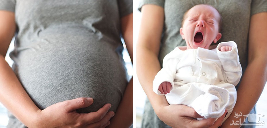 تغییرات گذرا و موقت بدن زنان باردار