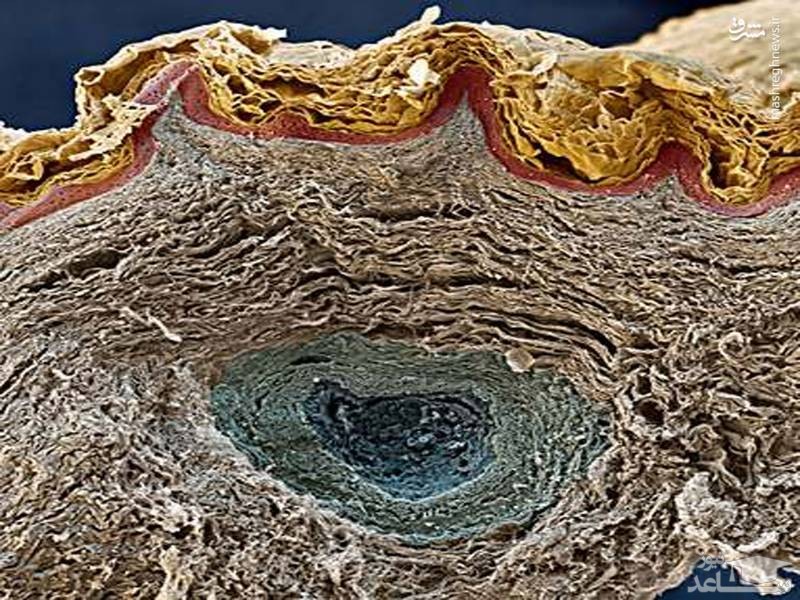 تصویری بسیار عجیب از پوست انسان زیر میکروسکوپ