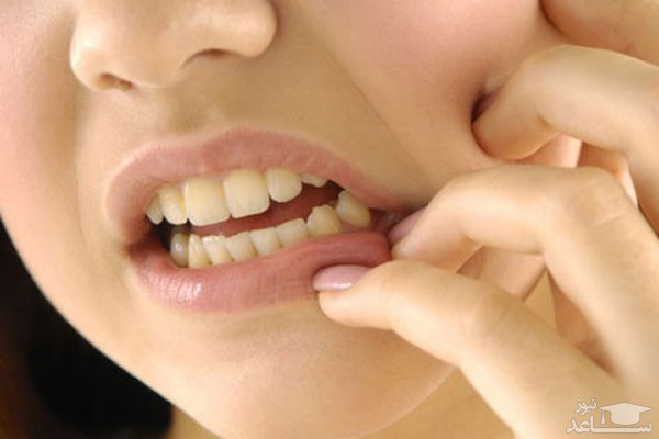 میزان و نحوه مصرف قطره دنتول