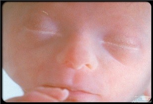 آیا زنان باردار میتوانند به سونا و جکوزی بروند؟