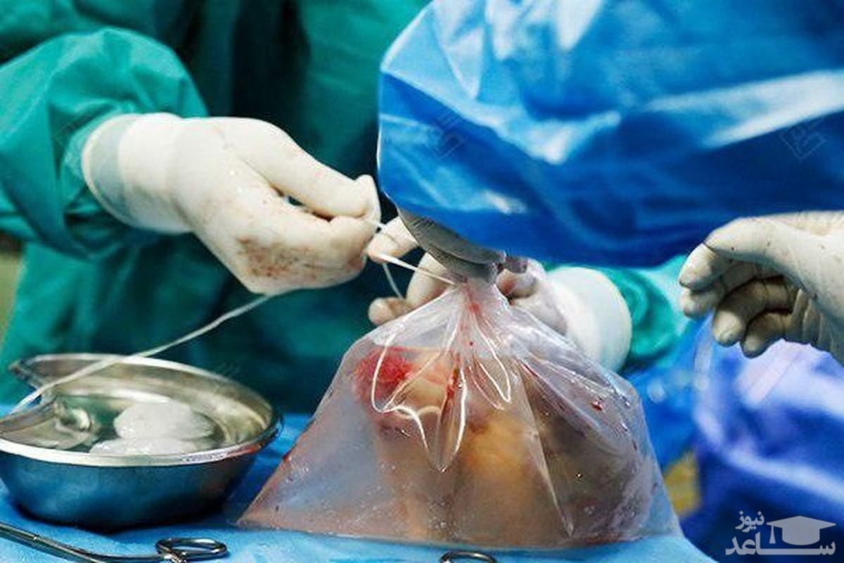 حسین کوچولو فرشته نجات 6 نفر در مشهد شد