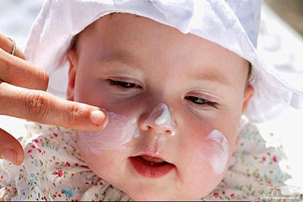 ضد آفتاب زدن به صورت نوزاد