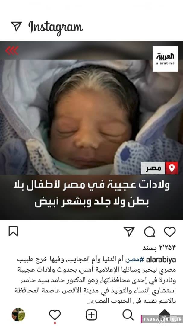 به دنیا آمدن نوزادی عجیب الخلقه در مصر