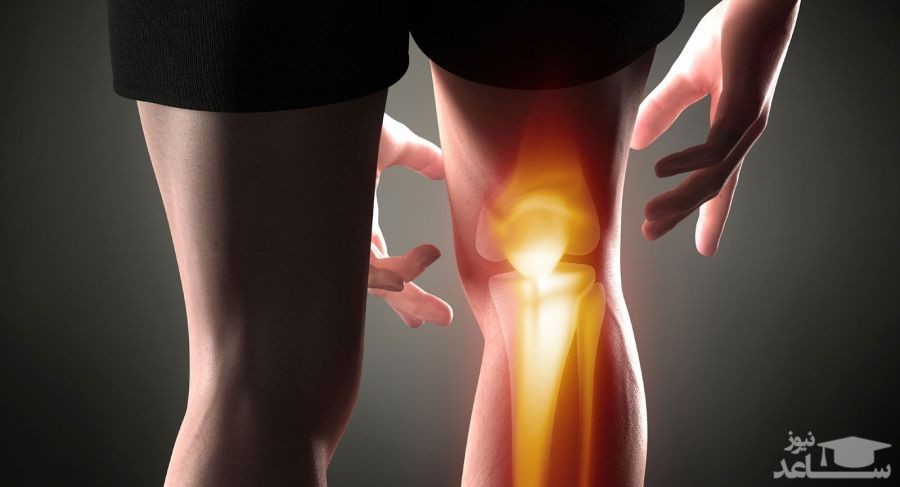 میزان و نحوه مصرف پماد متیل سالیسیلات