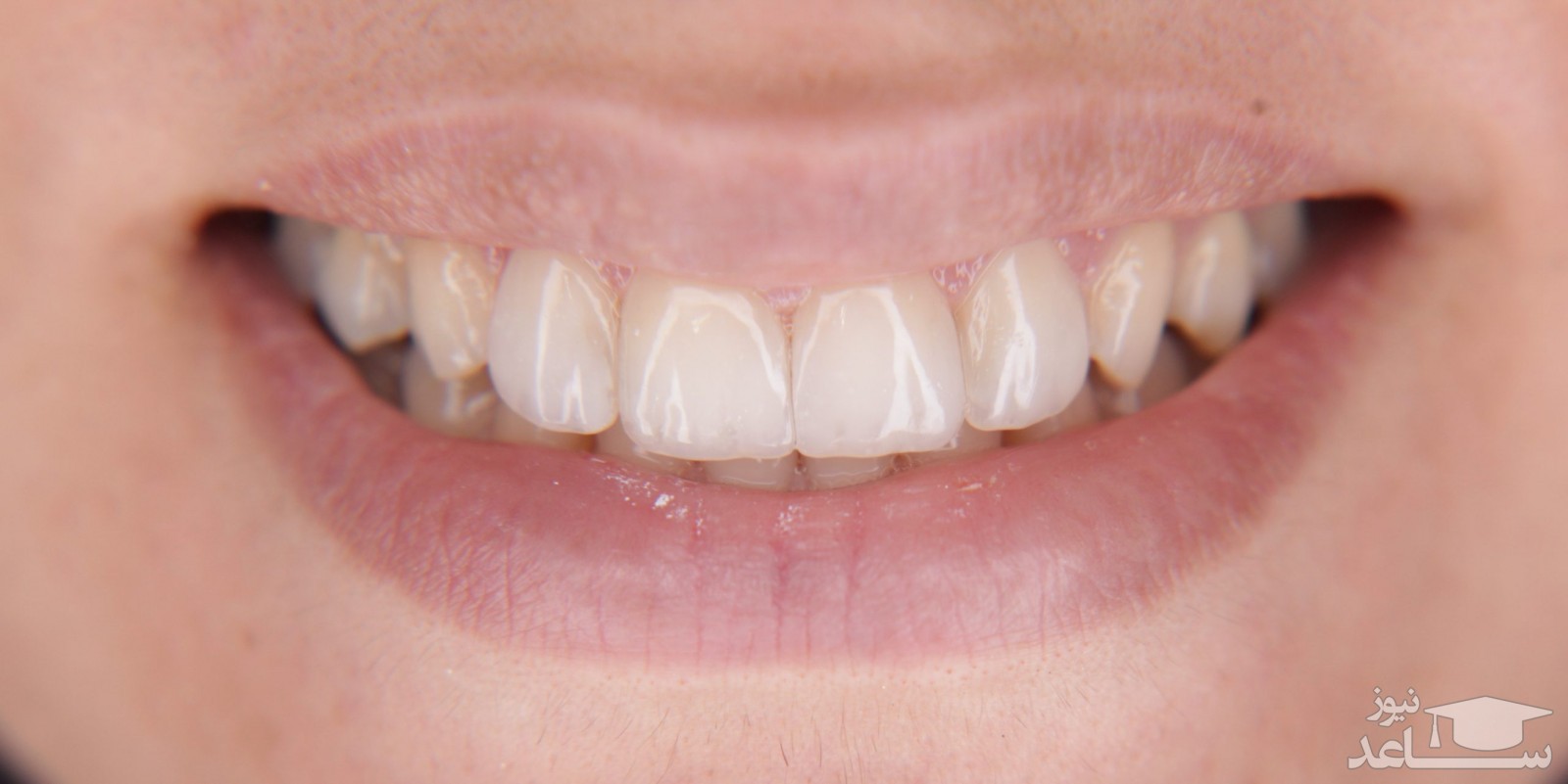 فرم دندان ها درباره شخصیت چه می گوید؟