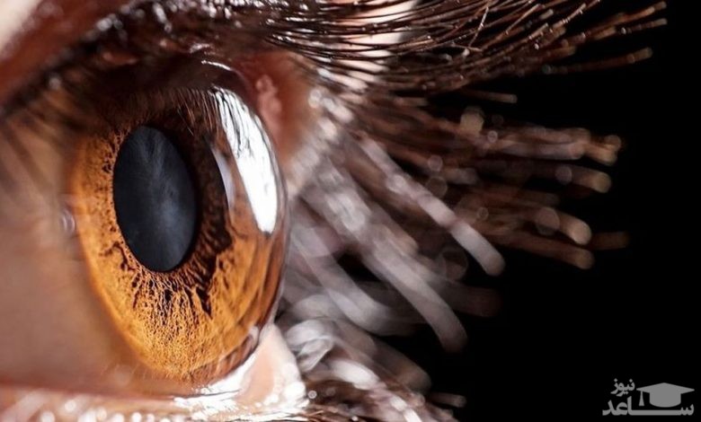 بیماری آب سیاه چشم چیست؟